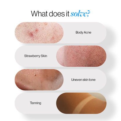 BeBodywise 5% AHA BHA Exfoliating Body Wash - Dista