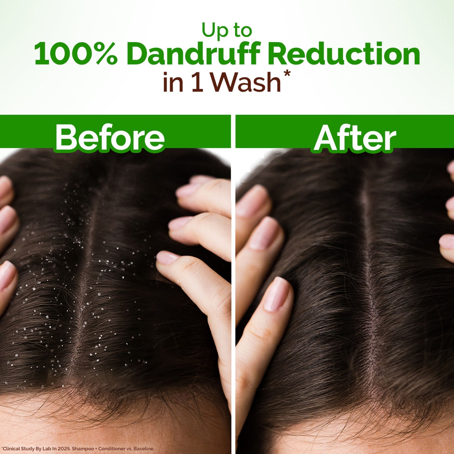 Mamaearth Lemon Anti-Dandruff Shampoo - Dista
