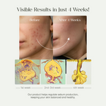 Thumbnail for Seoulskin Heartleaf Cleansing Oil - Distacart