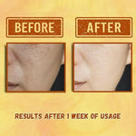 Thumbnail for Our Cares Vitamin C Face Cream for Glowing & Clear Skin - Distacart