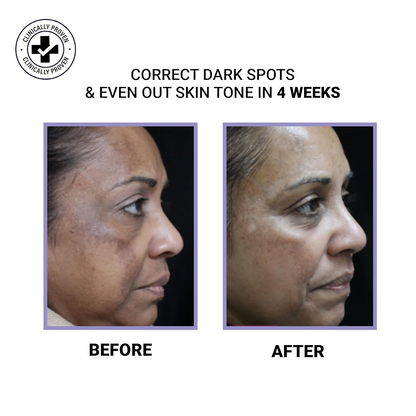 Sereko Vitamin C Night Face Cream for Brightening & Glowing Skin - Distacart