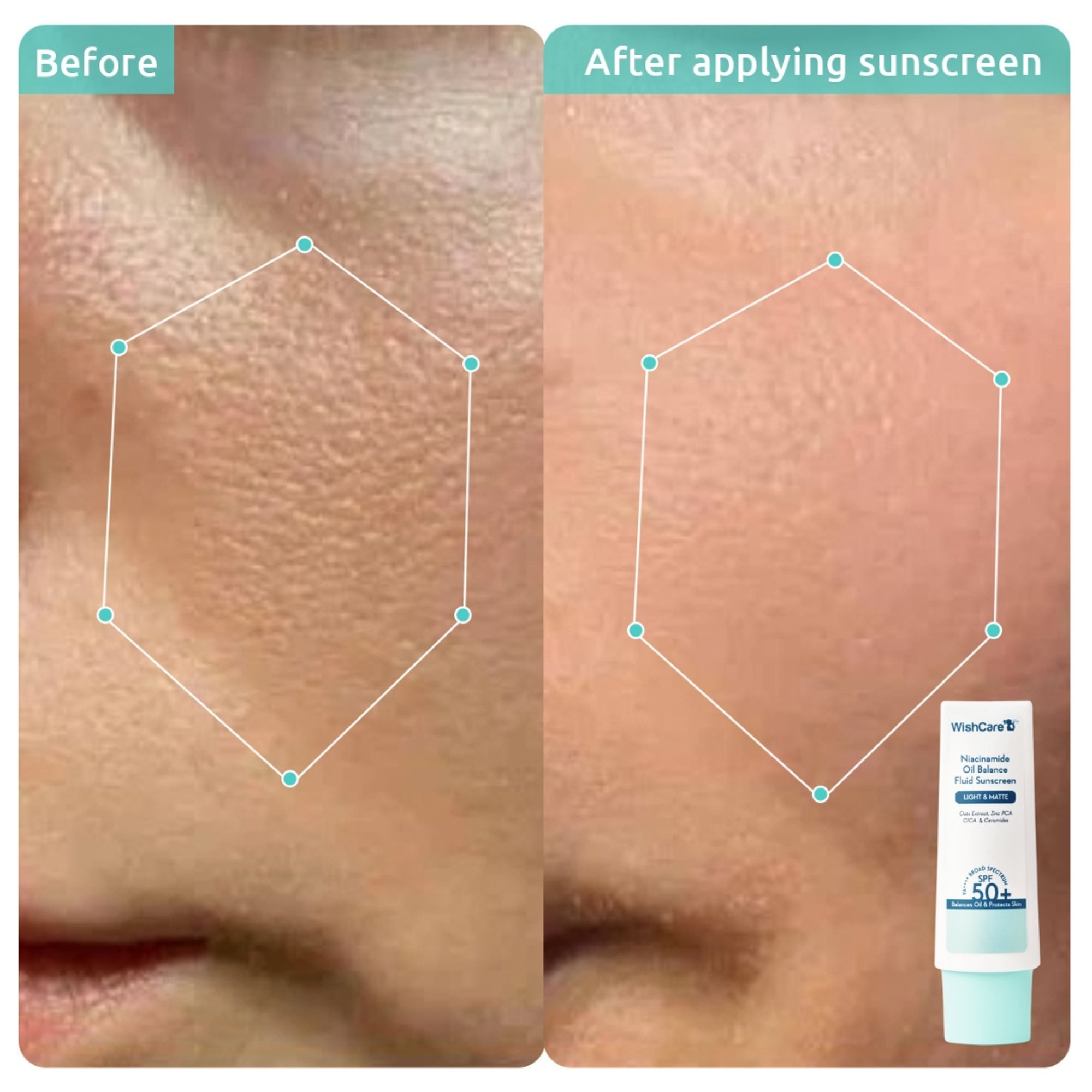 Wishcare Iconic SPF Essentials Head-to-Toe Sun Protection SPF 50+ PA++++ Exclusive Gift Box - Dista
