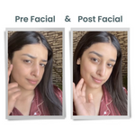 Thumbnail for Alps Goodness Diamond Hydrating Facial Kit