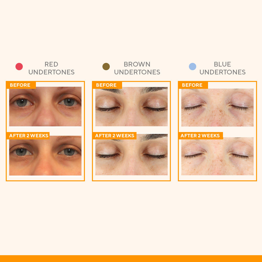 Murad Vitamin C Eyes Dark Circle Corrector - Distacart