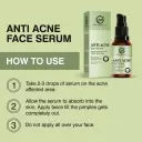 Thumbnail for Nuerma Science Anti Acne Face Serum | Clear, Calm, and Brighten Skin