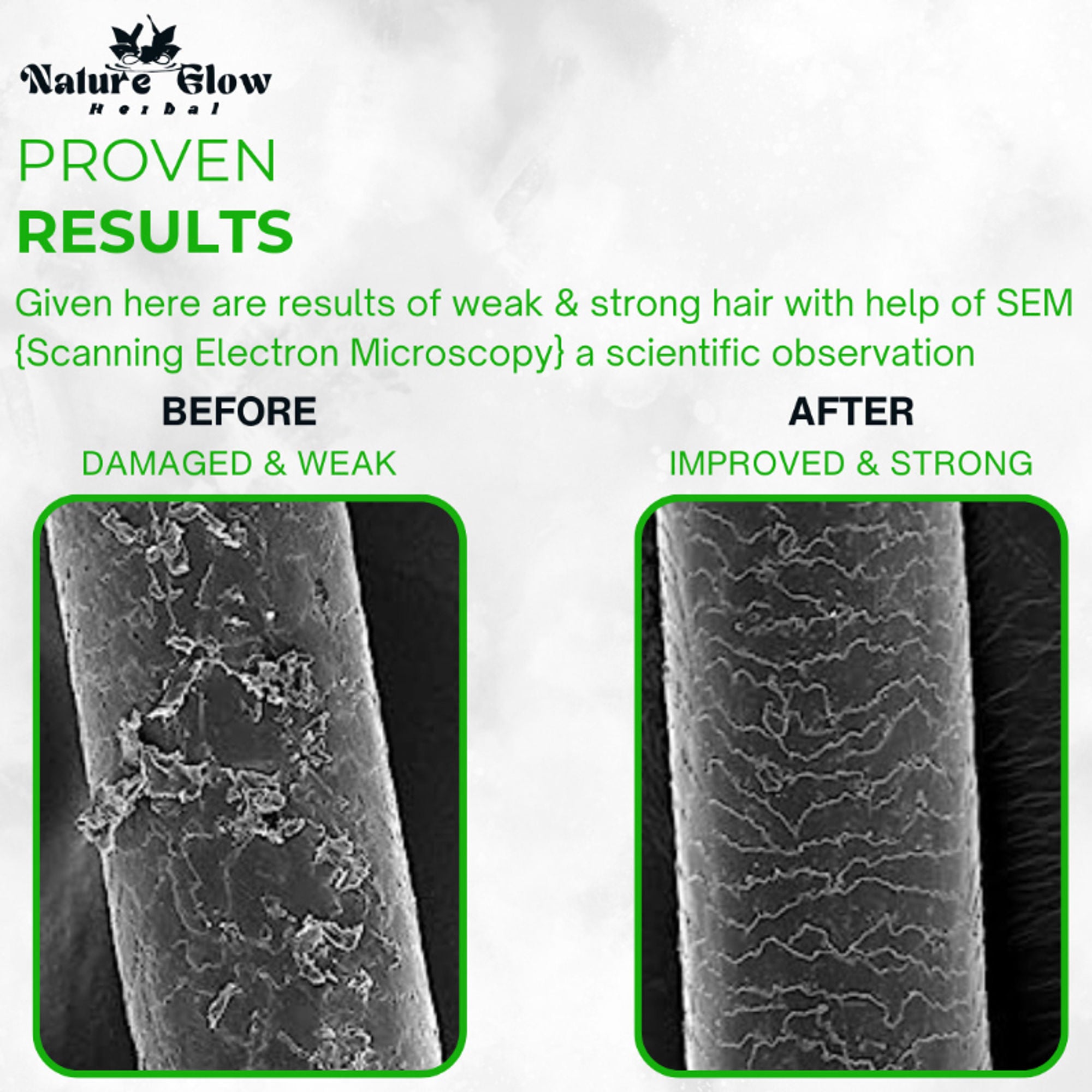 Nature Glow Herbal Advanced Hair Growth Vitalizer Serum - Distacart