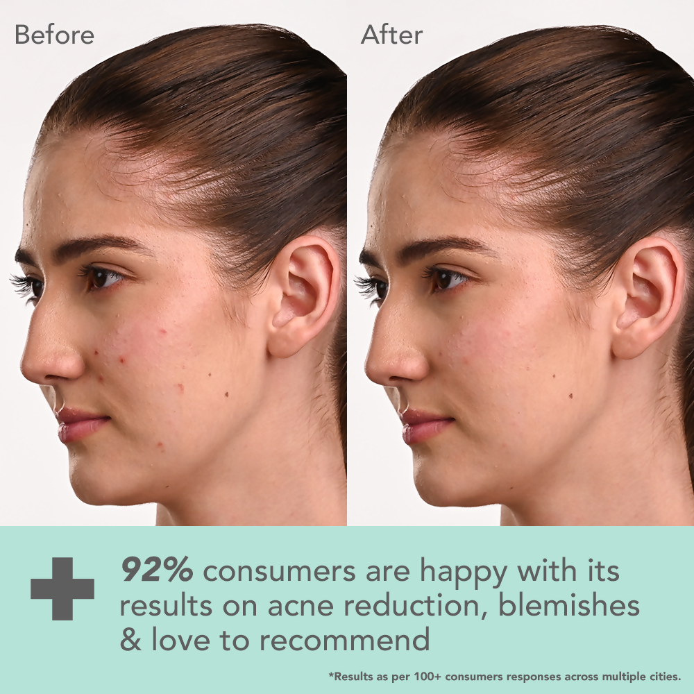 Lotus DermaBotanics Kojic acid + Multi berry Blemish - Free Facewash - Distacart