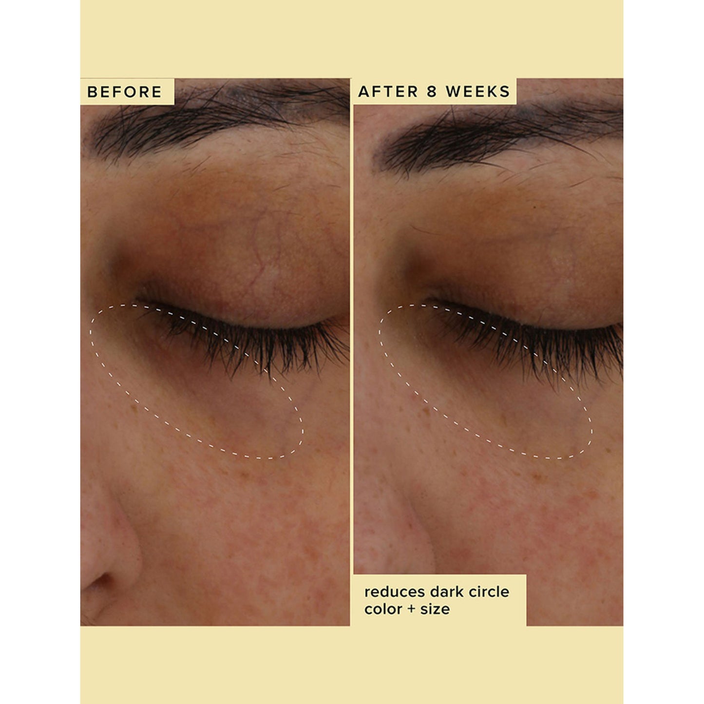 Farmacy Beauty Wake Up Honey Eye Cream - Distacart