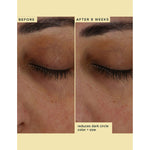 Thumbnail for Farmacy Beauty Wake Up Honey Eye Cream