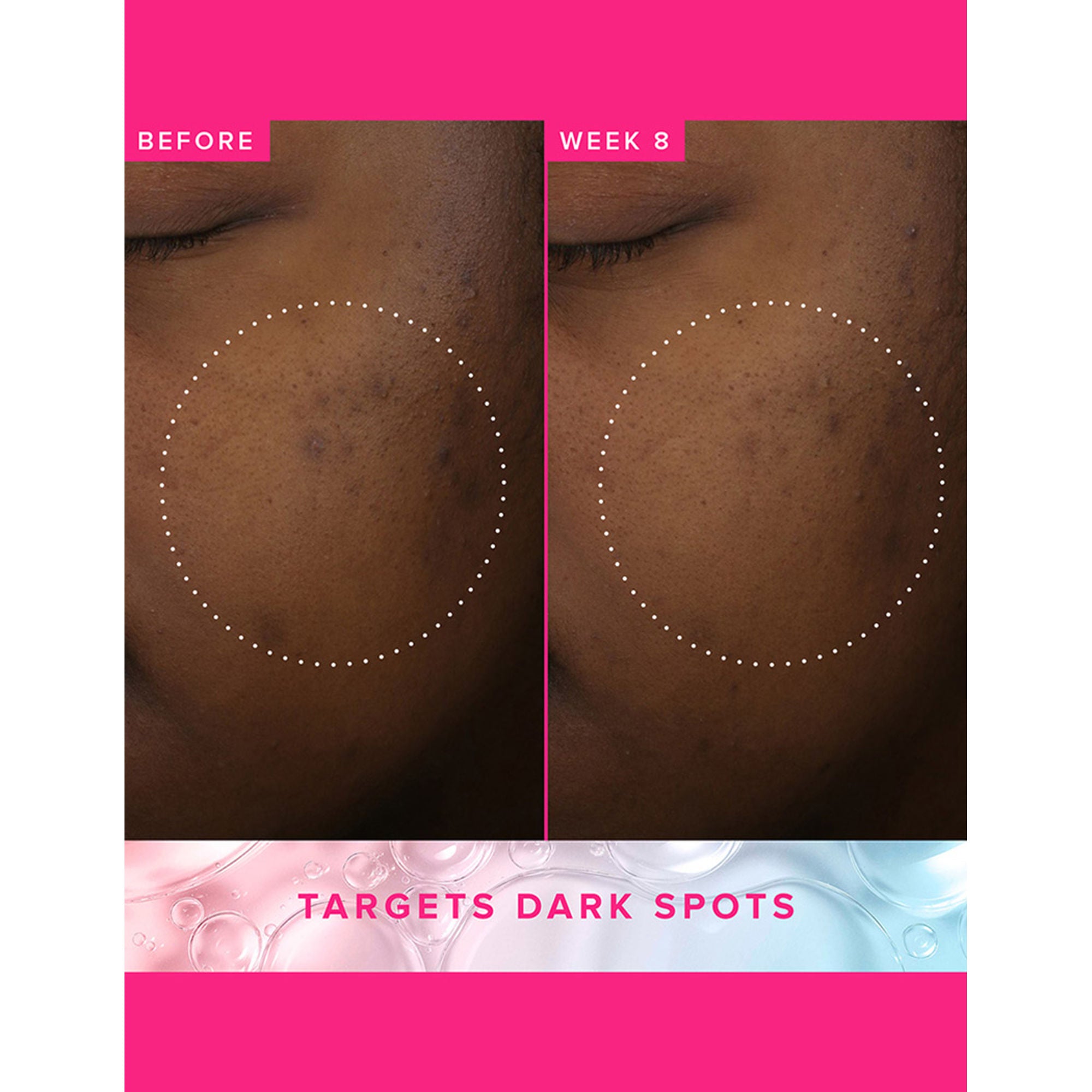 Farmacy Beauty Brighten Up 3% TXA Dark Spot Toner