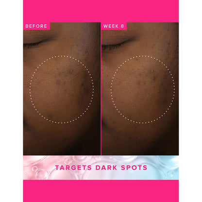 Farmacy Beauty Brighten Up 3% TXA Dark Spot Toner - Distacart