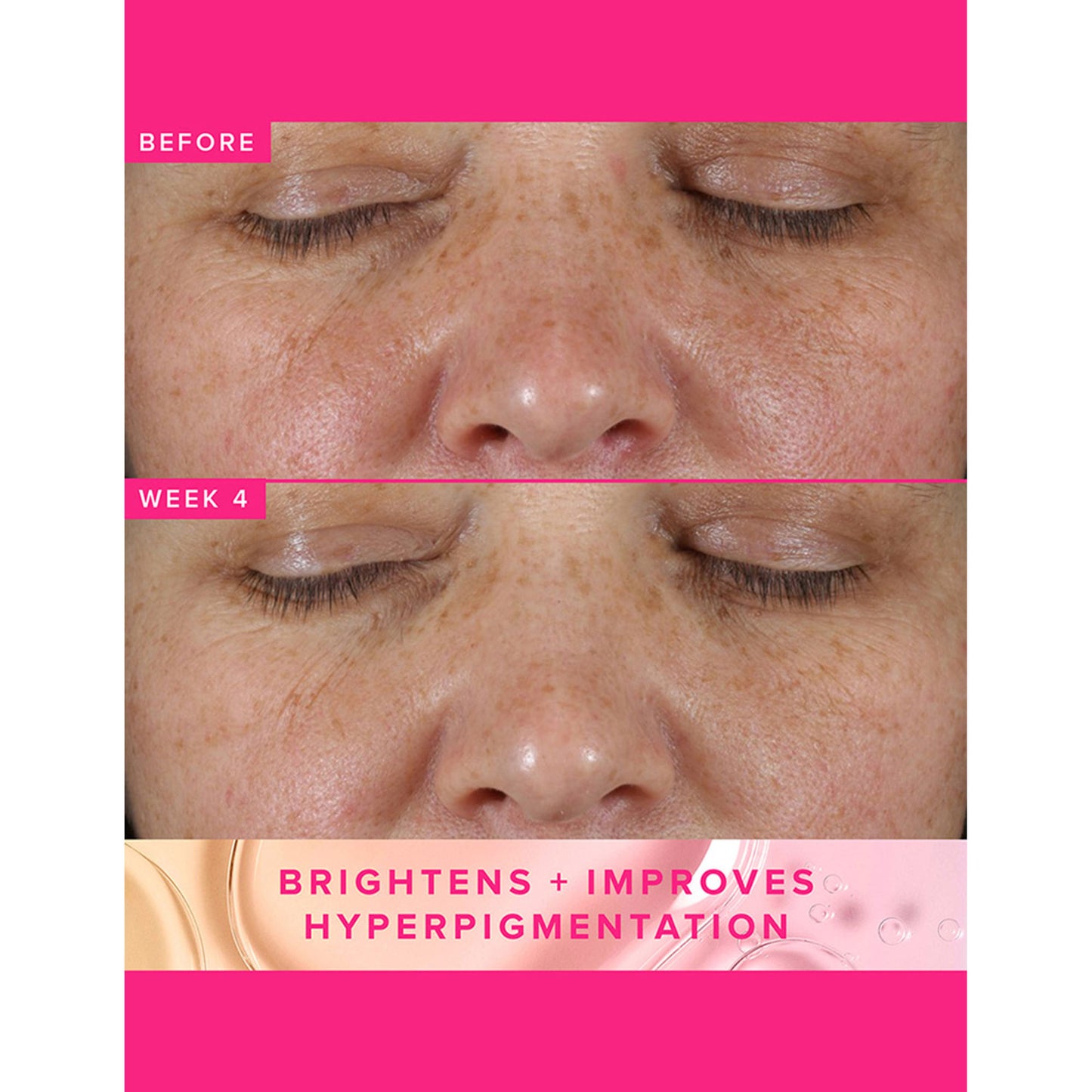 Farmacy Beauty Brighten Up 3% TXA Dark Spot Toner - Distacart