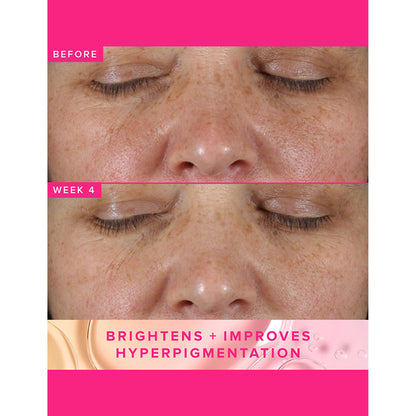 Farmacy Beauty Brighten Up 3% TXA Dark Spot Toner - Distacart
