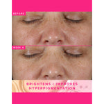 Thumbnail for Farmacy Beauty Brighten Up 3% TXA Dark Spot Toner