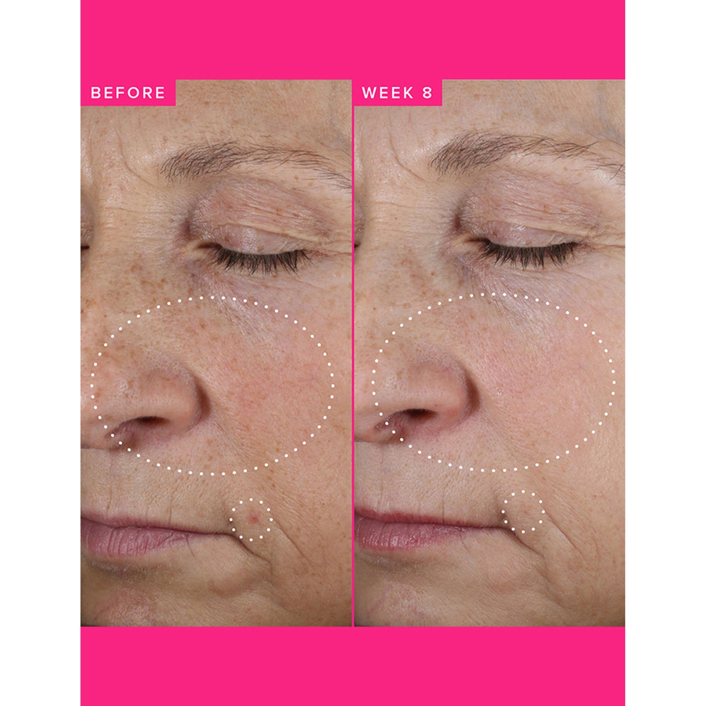 Farmacy Beauty Brighten Up 3% TXA Dark Spot Toner - Distacart