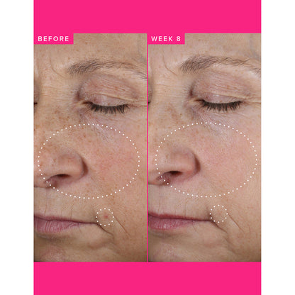 Farmacy Beauty Brighten Up 3% TXA Dark Spot Toner - Distacart