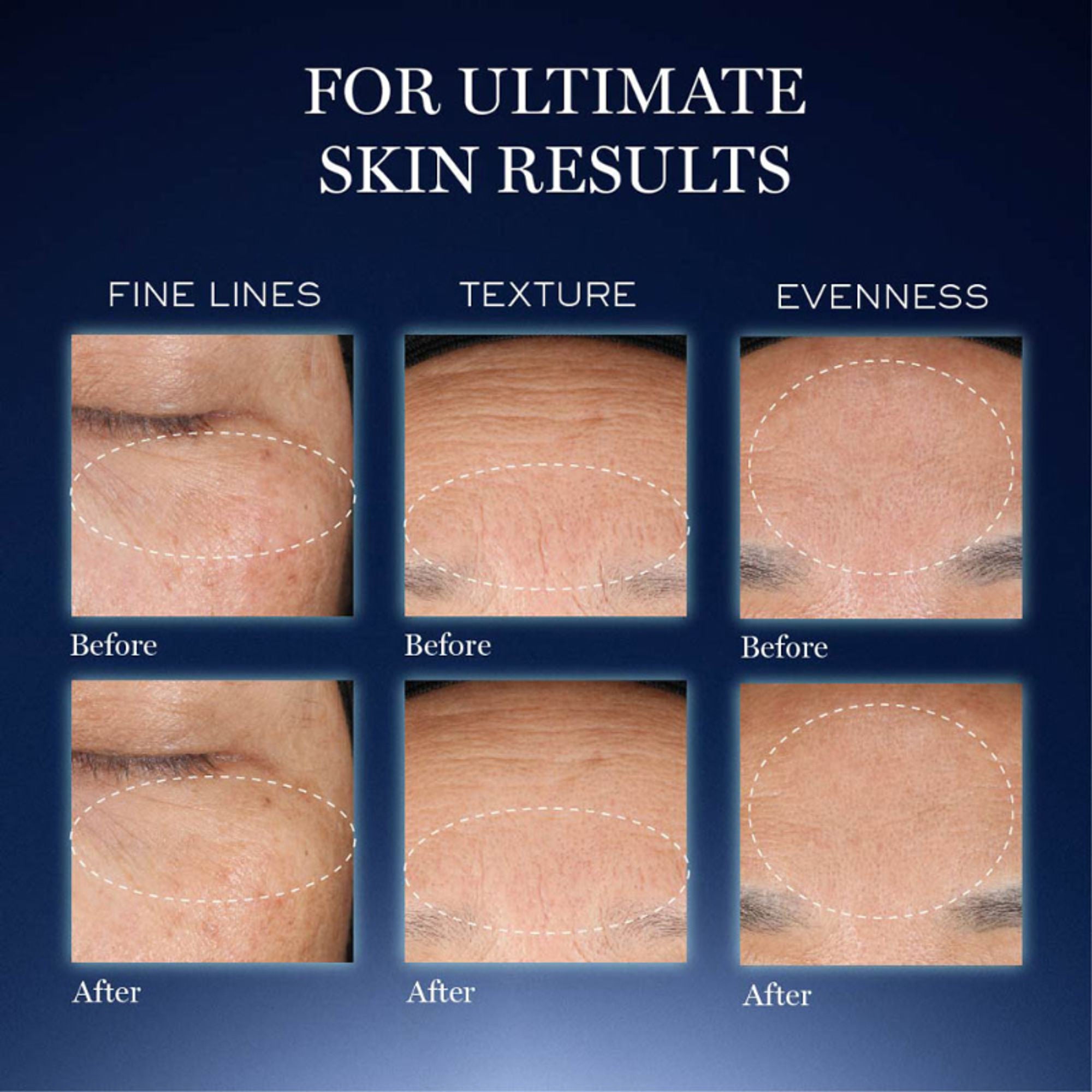 Lancome Genifique Ultimate Skin Repair Serum With Beta Glucan - Distacart