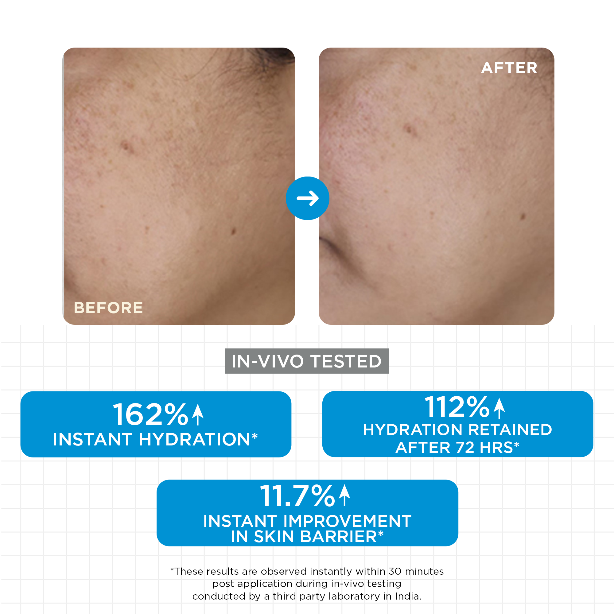 SkinQ Moisture Balm - Distacart