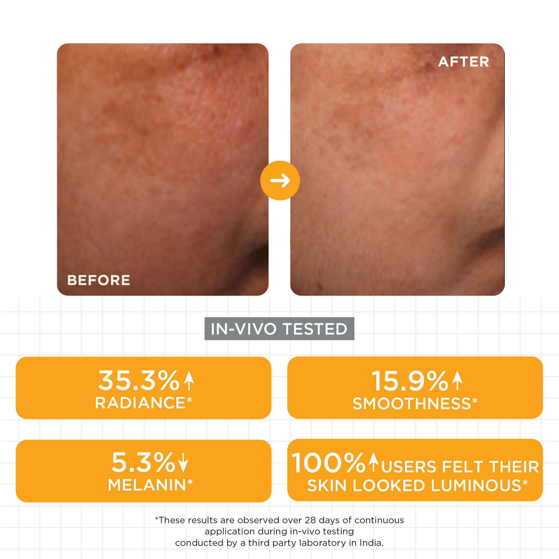 SkinQ Brightening Serum with Kojic, Lactic & Malic Acid - Distacart