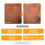 Thumbnail for SkinQ Brightening Serum with Kojic, Lactic & Malic Acid - Distacart