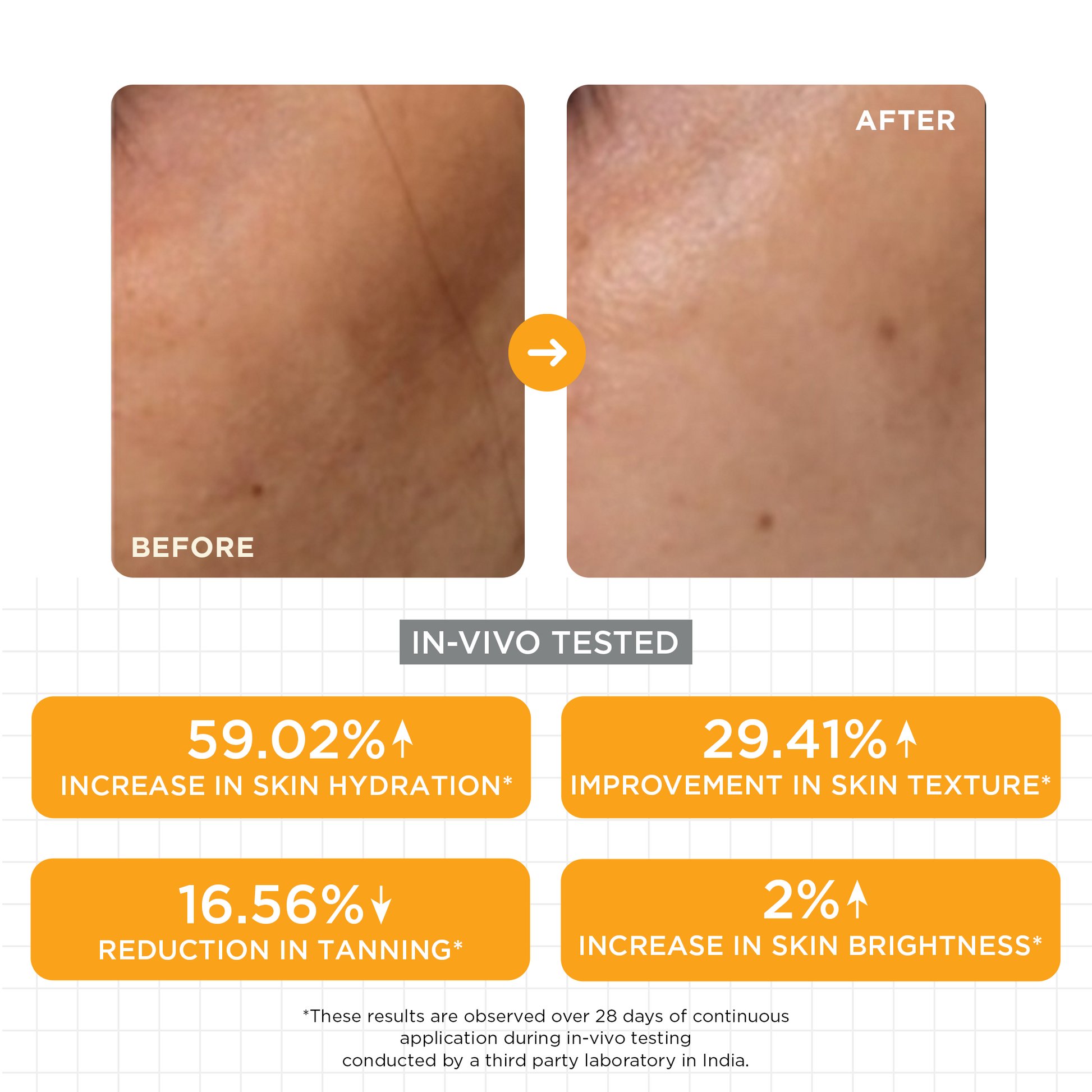 SKINQ 15% Vitamin C Glow Serum with L Ascorbic & Ferulic Acid - Distacart