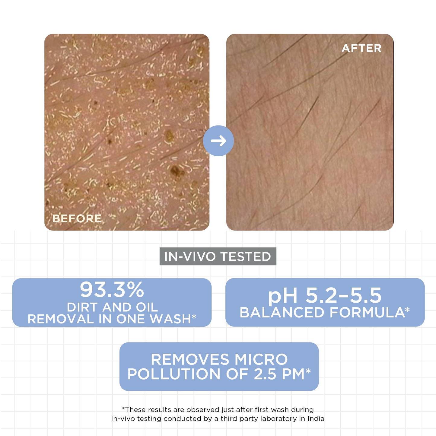 SkinQ Daily Gentle Cleanser - Distacart