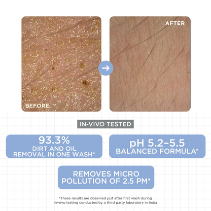 SkinQ Daily Gentle Cleanser - Distacart