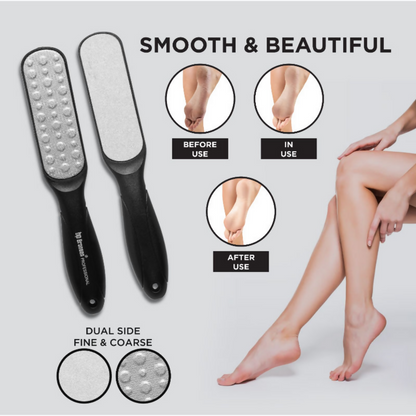 Bronson Professional Callus Remover Foot Scrubber - Dista