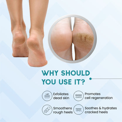 SANCTUS 20% Urea & Hyaluronic Foot Cream Roll On - Distacart