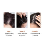 Thumbnail for SANCTUS 4% Dandelix Pro Anti-Dandruff Hair Serum For Scalp - Distacart