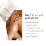 Thumbnail for Personal Touch Skincare Intenseal Face & Body Balm For Extreme Dryness, Eczema, Psoriasis & Kid Safe - Distacart