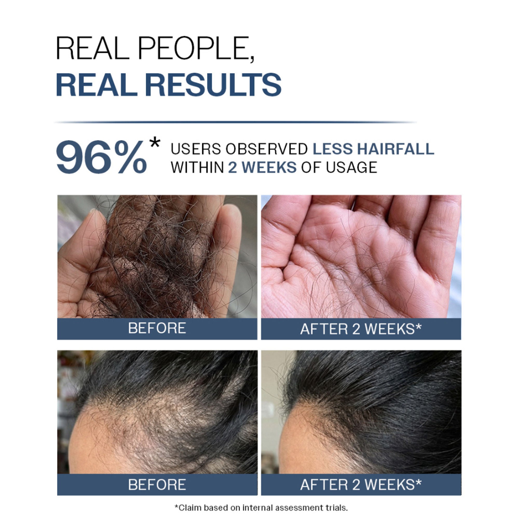 Bare Anatomy Anti-Hair Fall Shampoo 5X Hair Fall Control With Peptides - Dista
