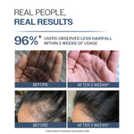 Thumbnail for Bare Anatomy Anti-Hair Fall Shampoo 5X Hair Fall Control With Peptides - Dista