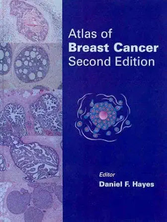 Atlas Of Breast Cancer - Daniel F. Hayes Md