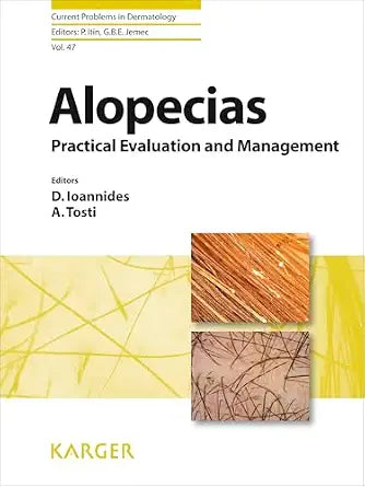 Alopecias: Practical Evaluation And Management (Current Problems In Dermatology) - D. Ioannides (Editor), A. Tosti (Editor), P. Itin (Editor), G. B. E. Jemec (Editor)