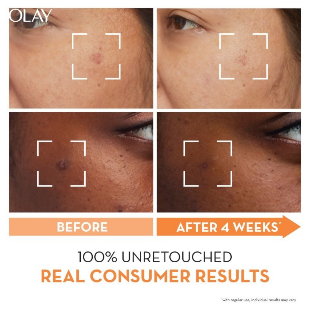 Olay Vitamin C Kit For 2x Glow - Cream With Free Cleanser - Distacart