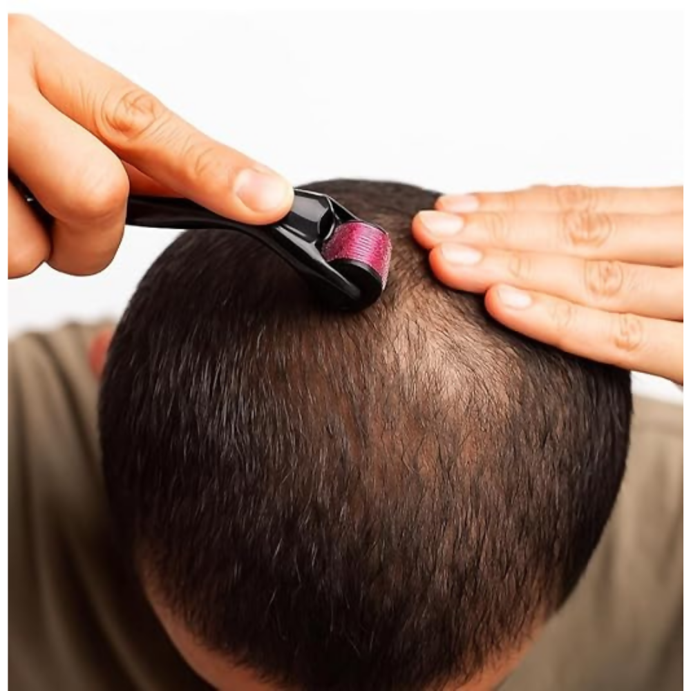 Bronson Professional Derma Roller 0.5mm for Hair & Beard Growth - Dista