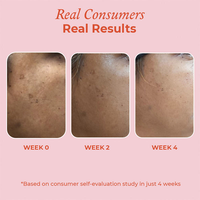 The Pink Foundry 15% Vitamin C Brightening Serum - Distacart