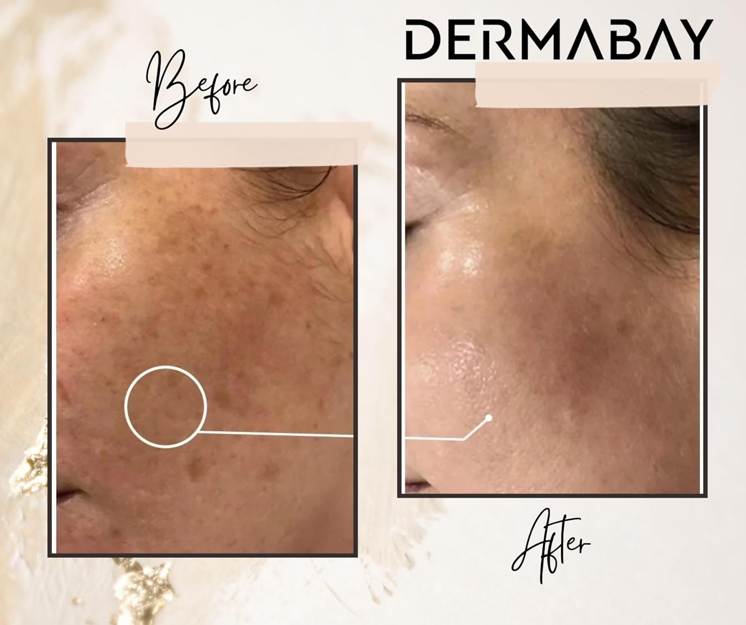 Dermabay Skin Brightening Face Serum With Kojic Acid & Alpha Arbutin - Distacart