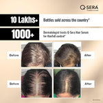 Thumbnail for QSERA Hair Serum for Hair Fall Control