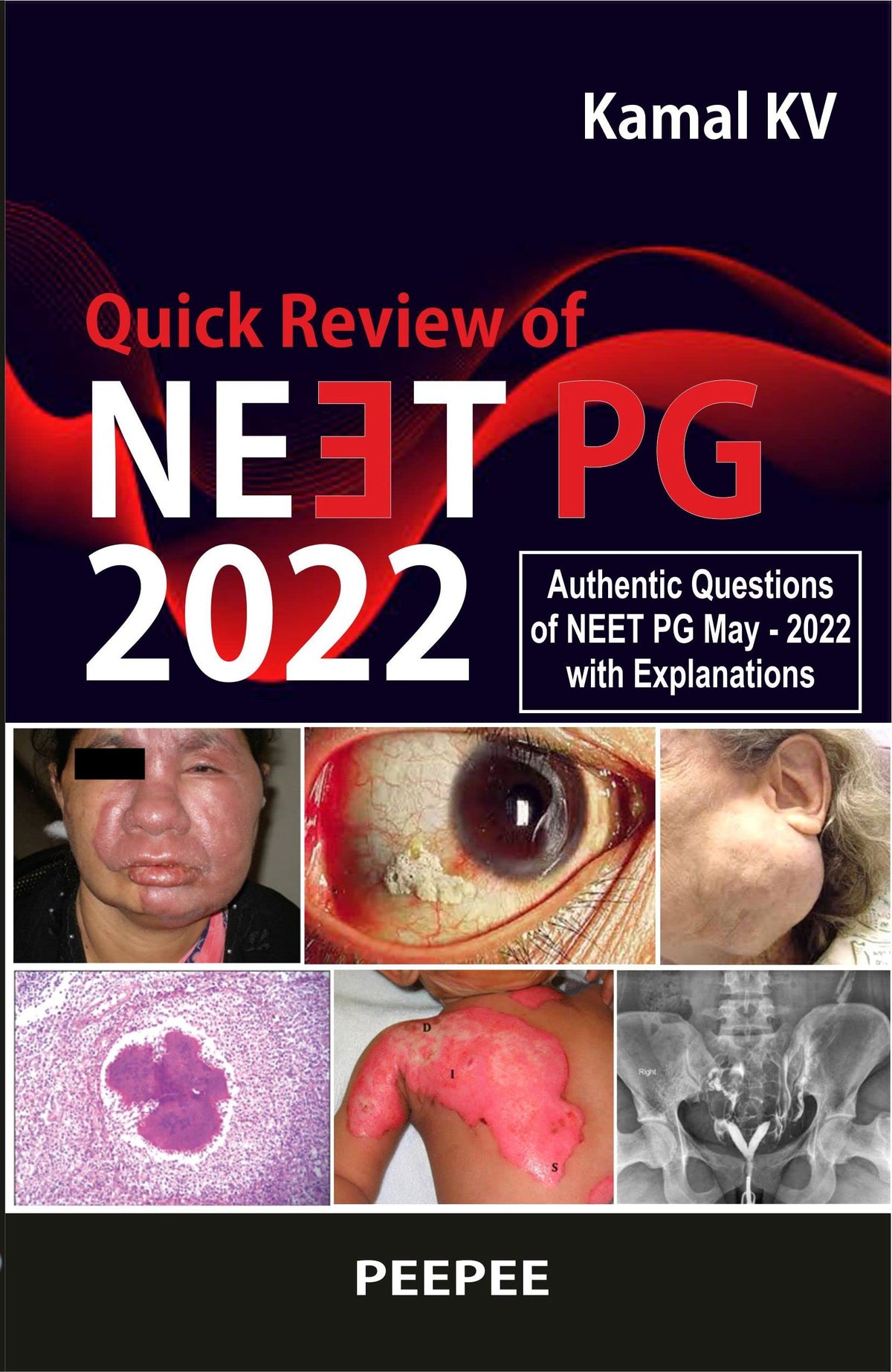 Quick Review Of Neet PG 2022-Kamal KV - Dista