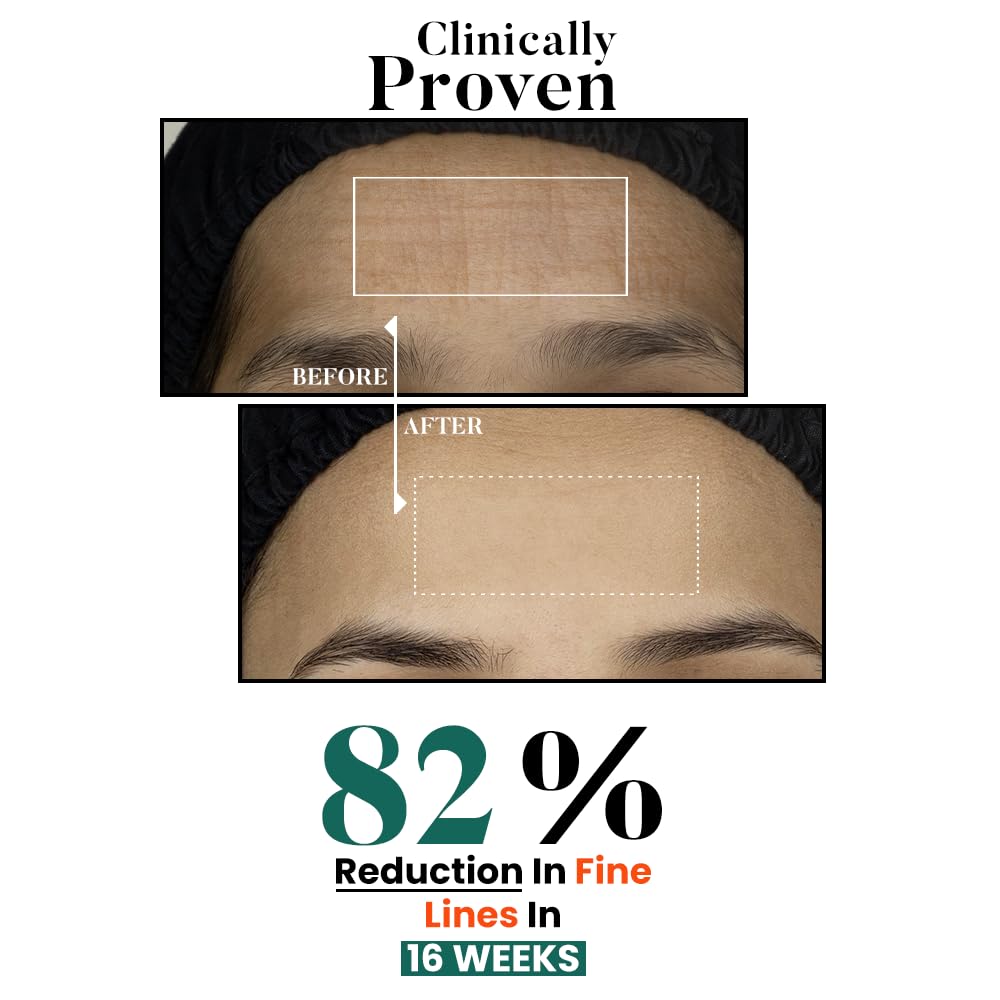Bio Code Exosome 0.1% & PDRN 0.4%, Peptide Complex 1.5% Multi-Molecular Hyaluronic Acid 1%, Ceramide Complex 1% Squalane 0.5%, Vitamin E 0.5% Renewal Moisturizer – Advanced Regenerative Anti-Aging | AI-Enhanced Formula | Dermatologist Recommended