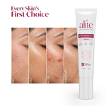 Thumbnail for Alite Spots Reduction Cream with 5X Enhanced Absorption - Distacart