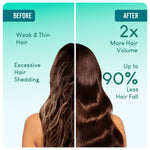 Thumbnail for Careberry 100% Organic Rosemary & Jojoba Anti Dandruff Hair Oil - Distacart