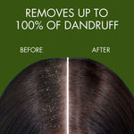 Thumbnail for Samisha Anti Dandruff Spray - Distacart