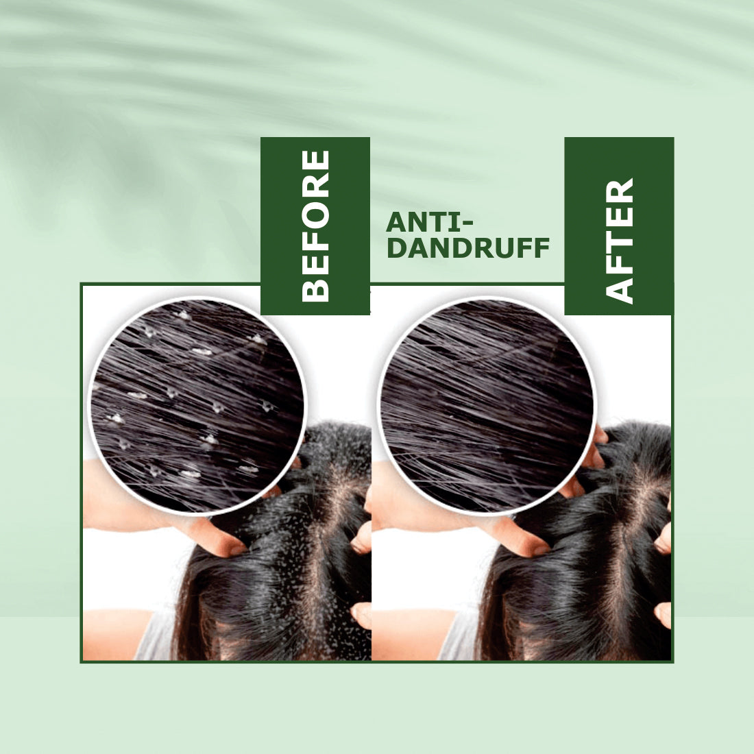 Nuerma Science Anti-Dandruff Oil | Rejuvenate Your Scalp, Rediscover Confidence - Distacart