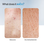 Thumbnail for BeBodywise 1% Salicylic Ceramide Body Wash - Dual Pump 2in1 Body Wash - For Body Acne and Dry Skin