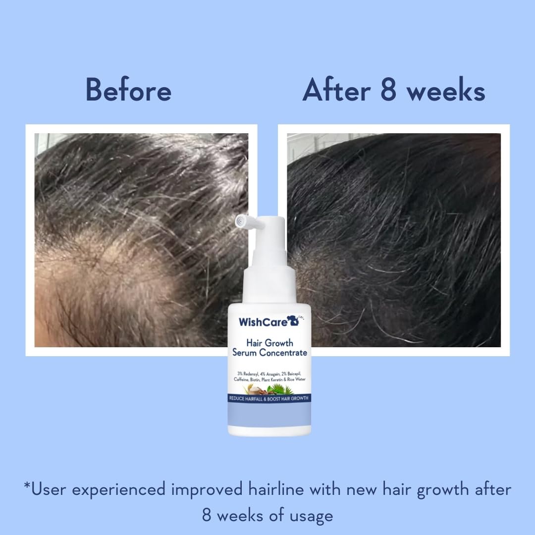 Wishcare Hair Growth Serum Concentrate With 3% Redensyl, 4% Anagain, Rice Water, Biotin - Distacart