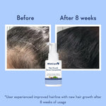 Thumbnail for Wishcare Hair Growth Serum Concentrate With 3% Redensyl, 4% Anagain, Rice Water, Biotin