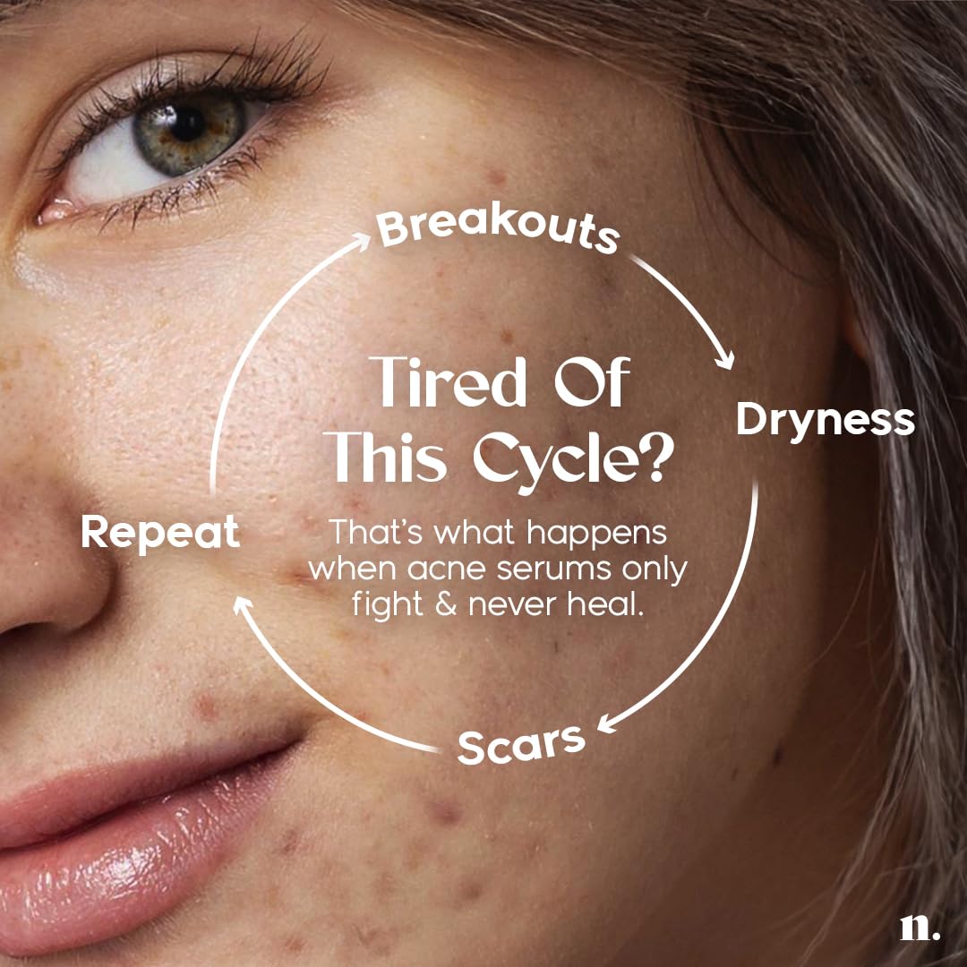 Numour No Breakouts Tonight| Dual Acne face Serum | 8% Actives 2% Encapsulated Salicylic + 4% Niacinamide + Azelaic Acid & Zinc | Acne‑Prone & Sensitive Skin